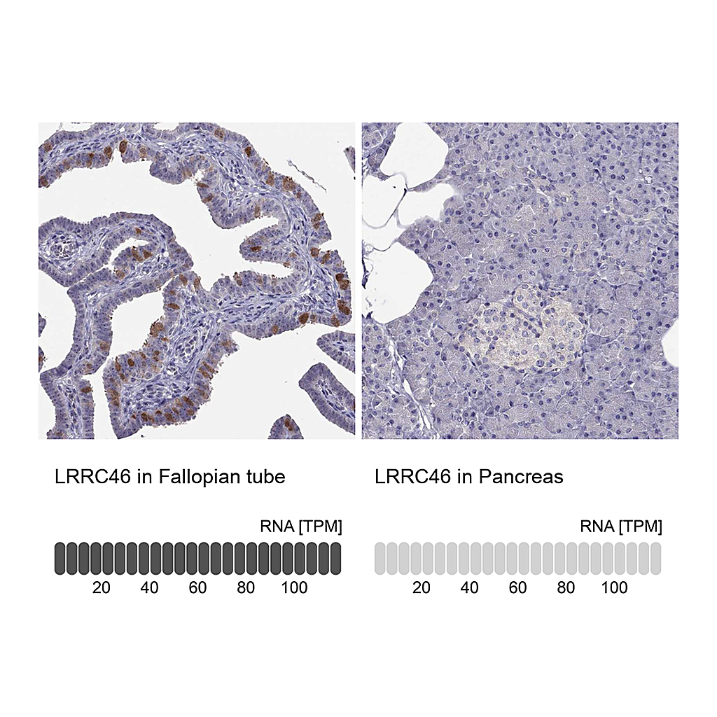 Atlas Antibodies Anti-LRRC46 Antibody