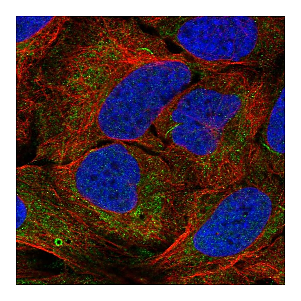 Atlas Antibodies Anti-AGPAT1 Antibody