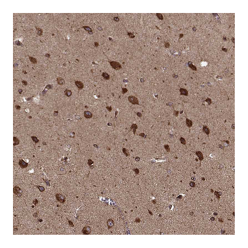 Atlas Antibodies Anti-AGPAT1 Antibody