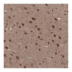 Atlas Antibodies Anti-AGPAT1 Antibody