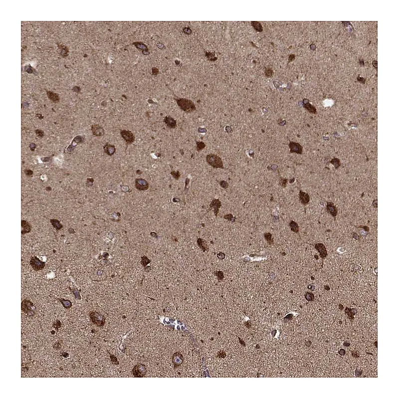 Atlas Antibodies Anti-AGPAT1 Antibody