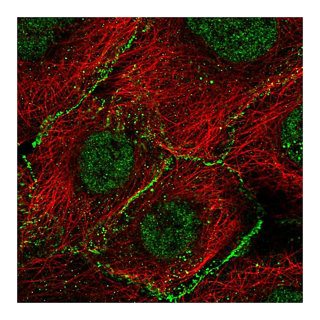 Atlas Antibodies Anti-AGO2 Antibody