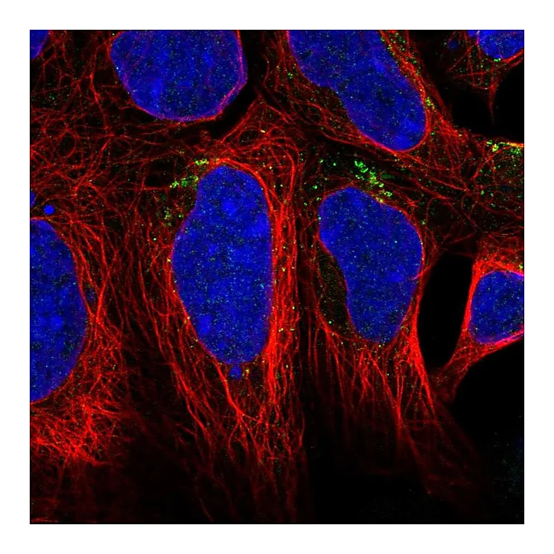 Atlas Antibodies Anti-AGPAT4 Antibody