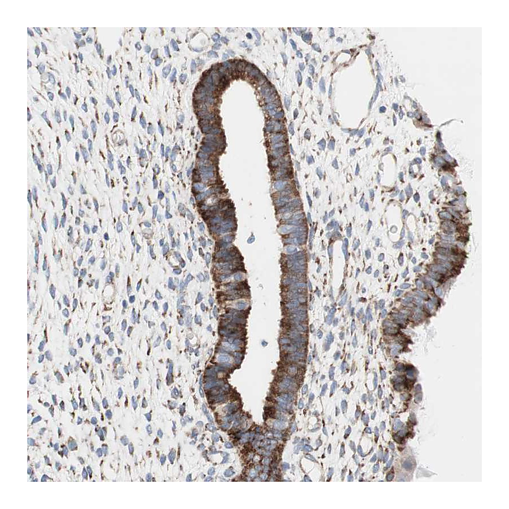 Atlas Antibodies Anti-AGPAT5 Antibody