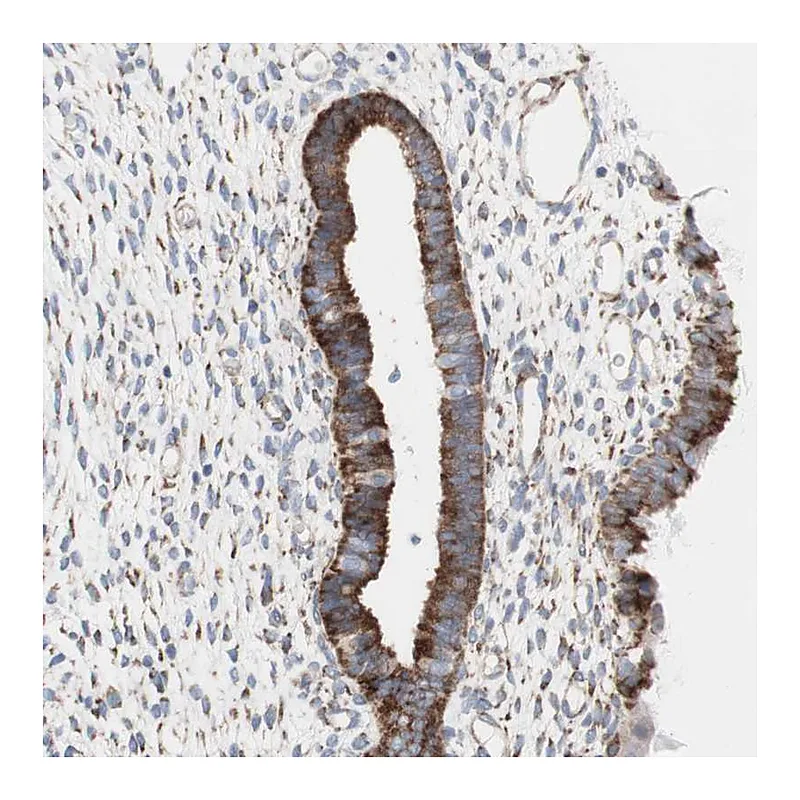Atlas Antibodies Anti-AGPAT5 Antibody