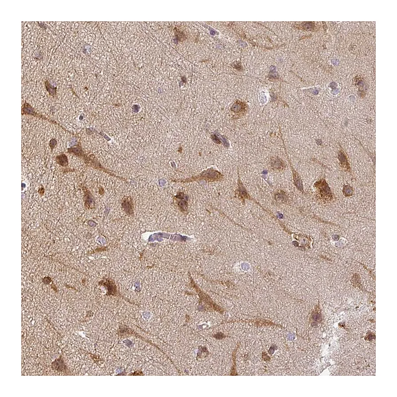 Atlas Antibodies Anti-AGPAT4 Antibody