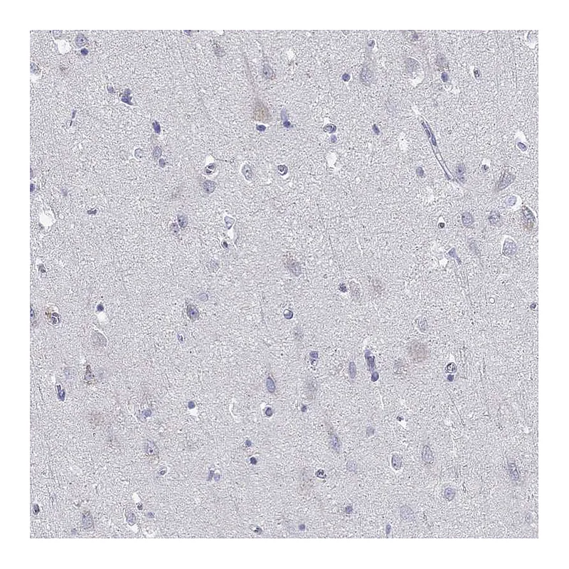 Atlas Antibodies Anti-LRRC4C Antibody