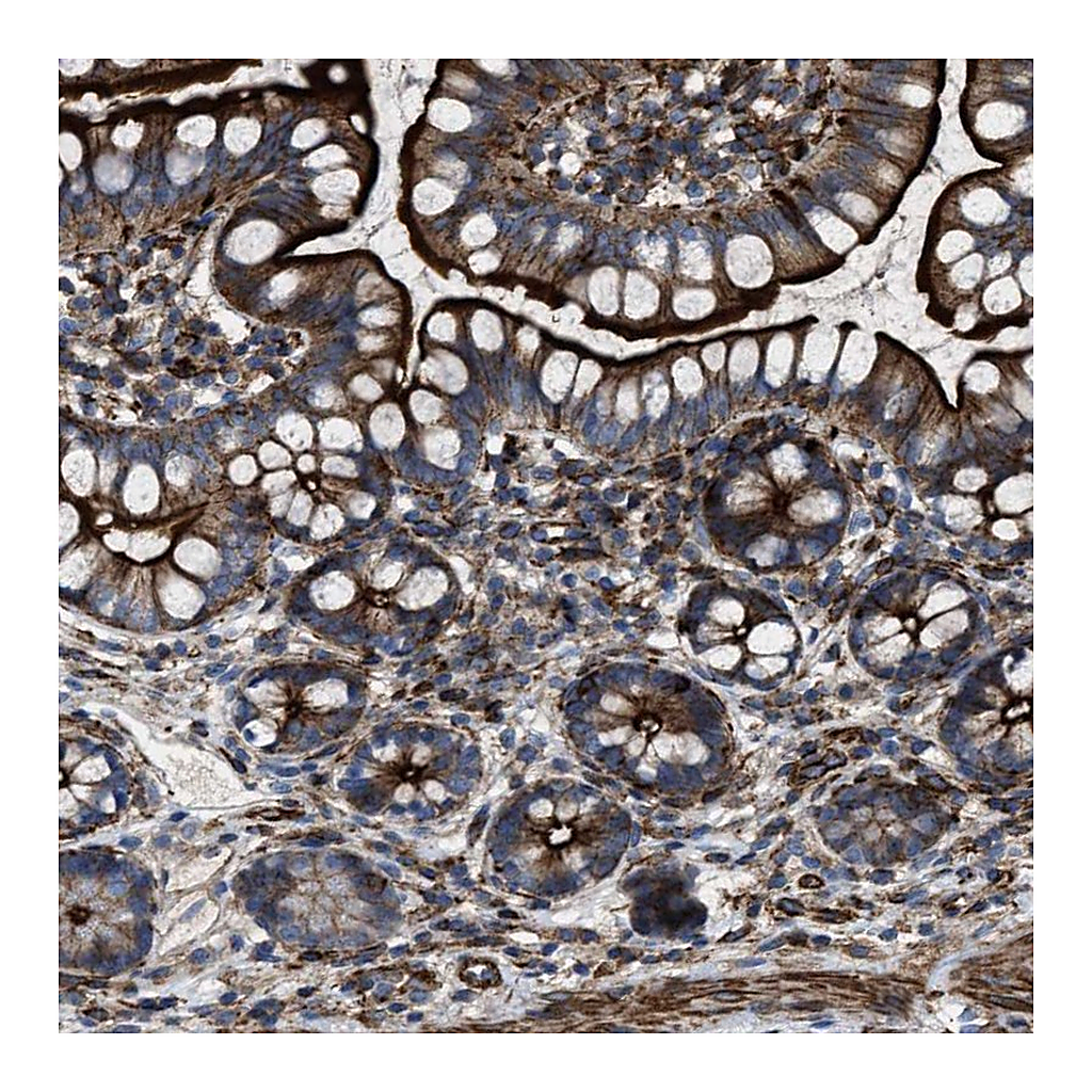 Atlas Antibodies Anti-AGPAT2 Antibody