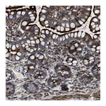 Atlas Antibodies Anti-AGPAT2 Antibody