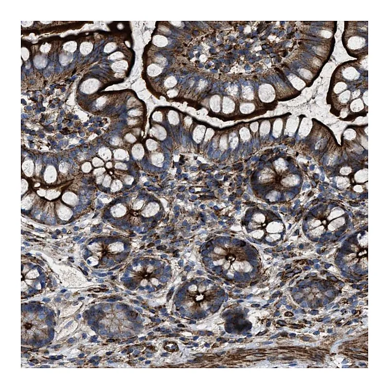 Atlas Antibodies Anti-AGPAT2 Antibody