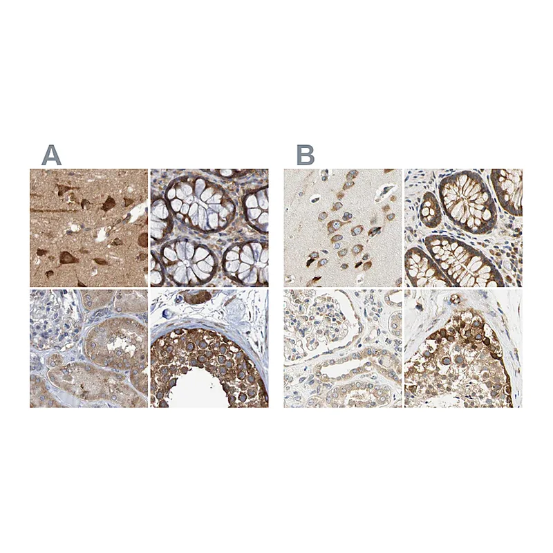 Atlas Antibodies Anti-LRRC47 Antibody