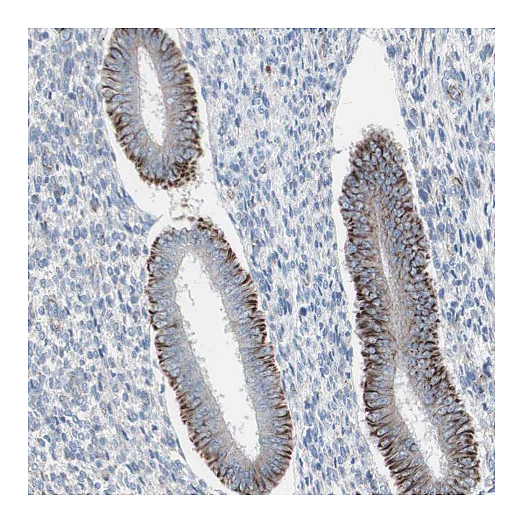 Atlas Antibodies Anti-AGPAT5 Antibody