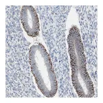 Atlas Antibodies Anti-AGPAT5 Antibody