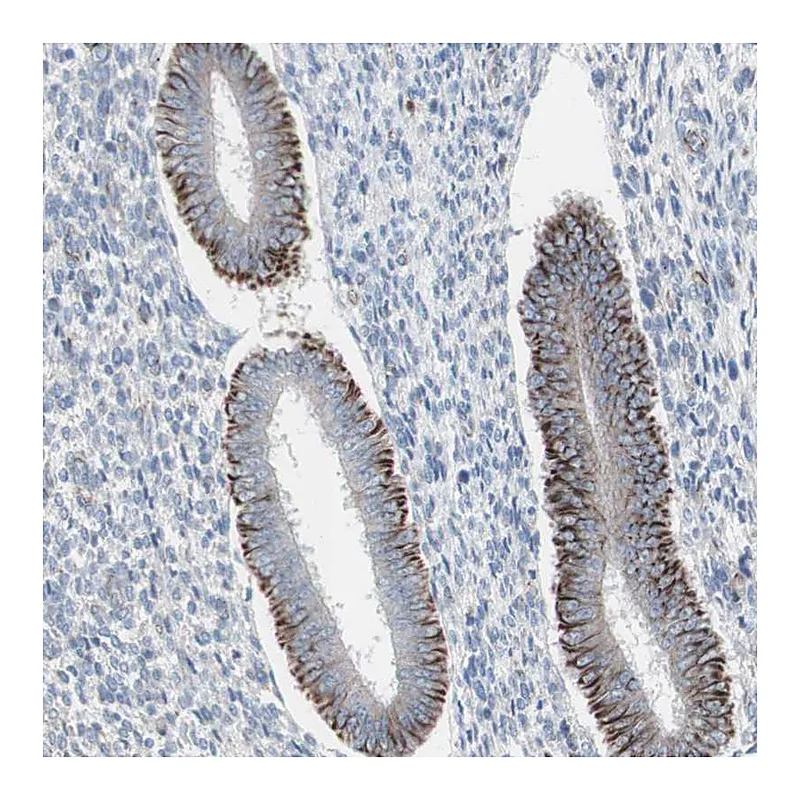 Atlas Antibodies Anti-AGPAT5 Antibody