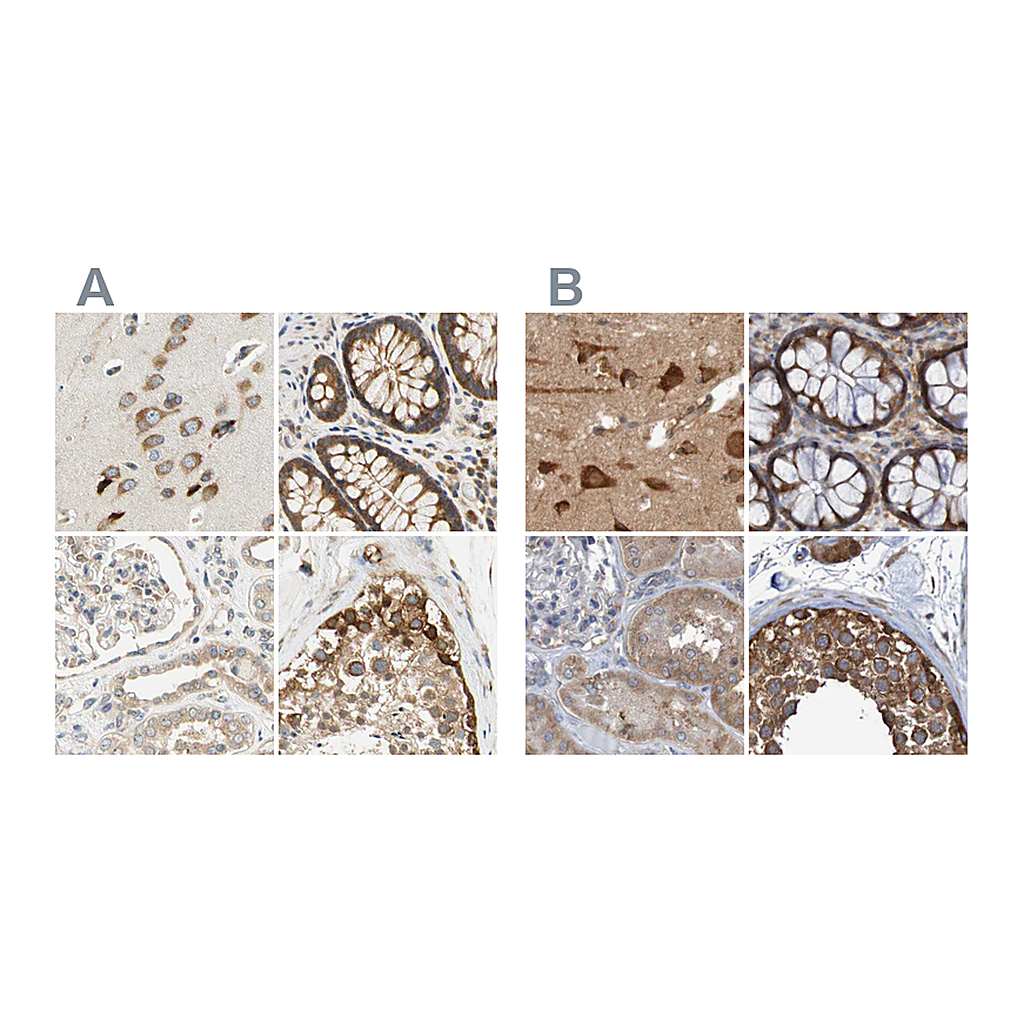 Atlas Antibodies Anti-LRRC47 Antibody