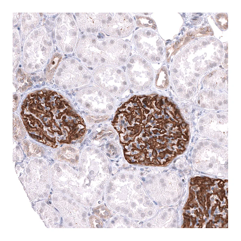 Atlas Antibodies Anti-LRRC55 Antibody