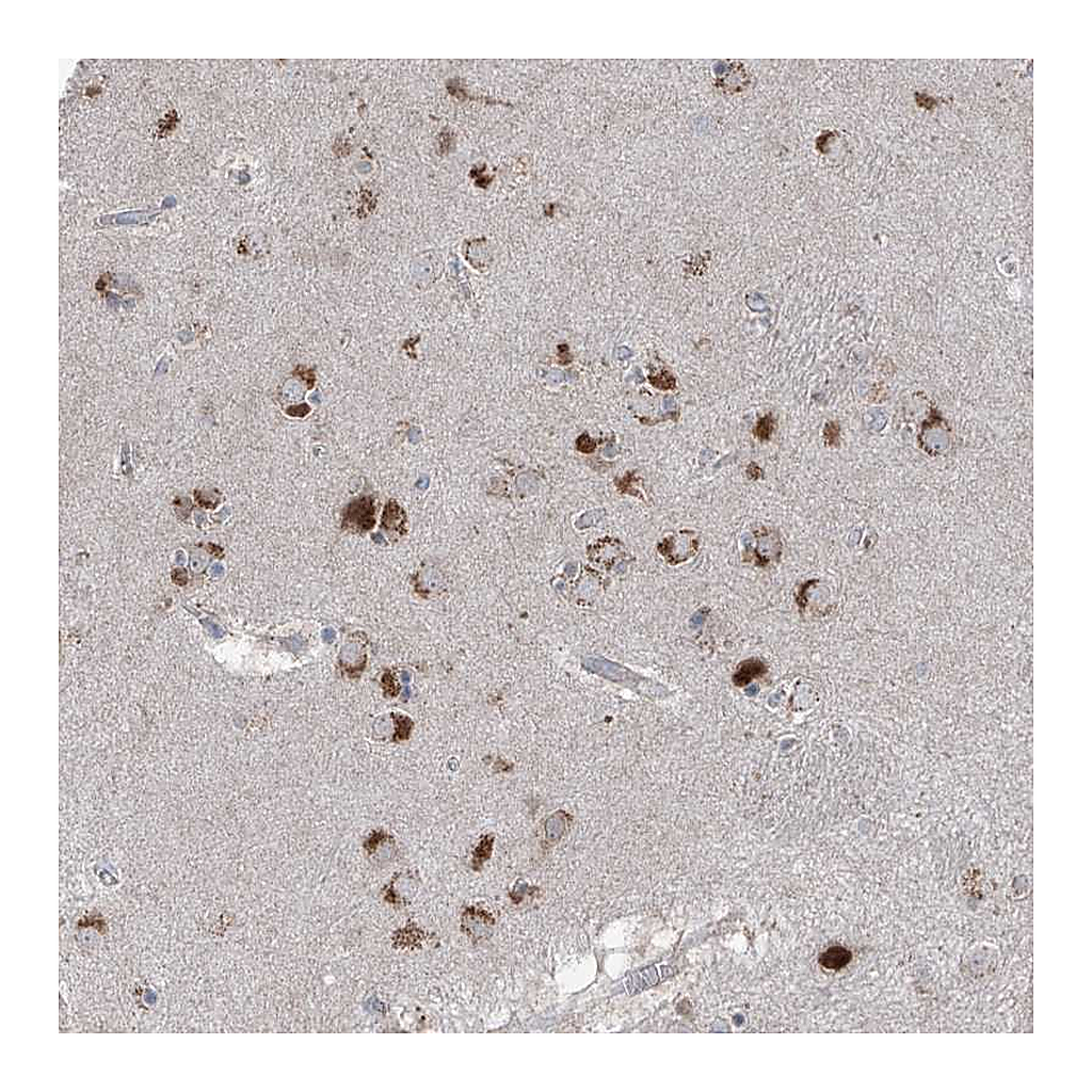 Atlas Antibodies Anti-AGPS Antibody