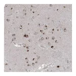 Atlas Antibodies Anti-AGPS Antibody