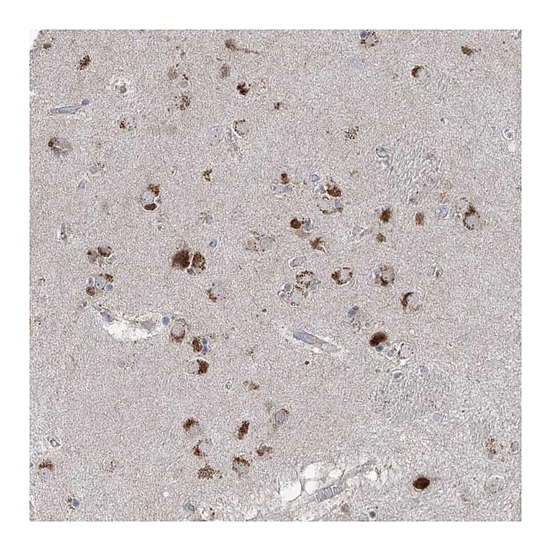 Atlas Antibodies Anti-AGPS Antibody