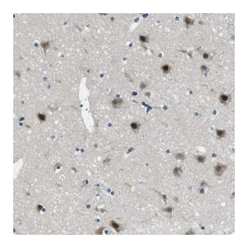 Atlas Antibodies Anti-LRRC49 Antibody