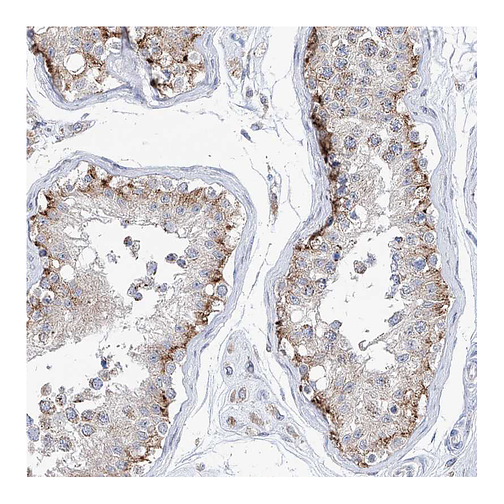 Atlas Antibodies Anti-AGPS Antibody