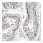 Atlas Antibodies Anti-AGPS Antibody