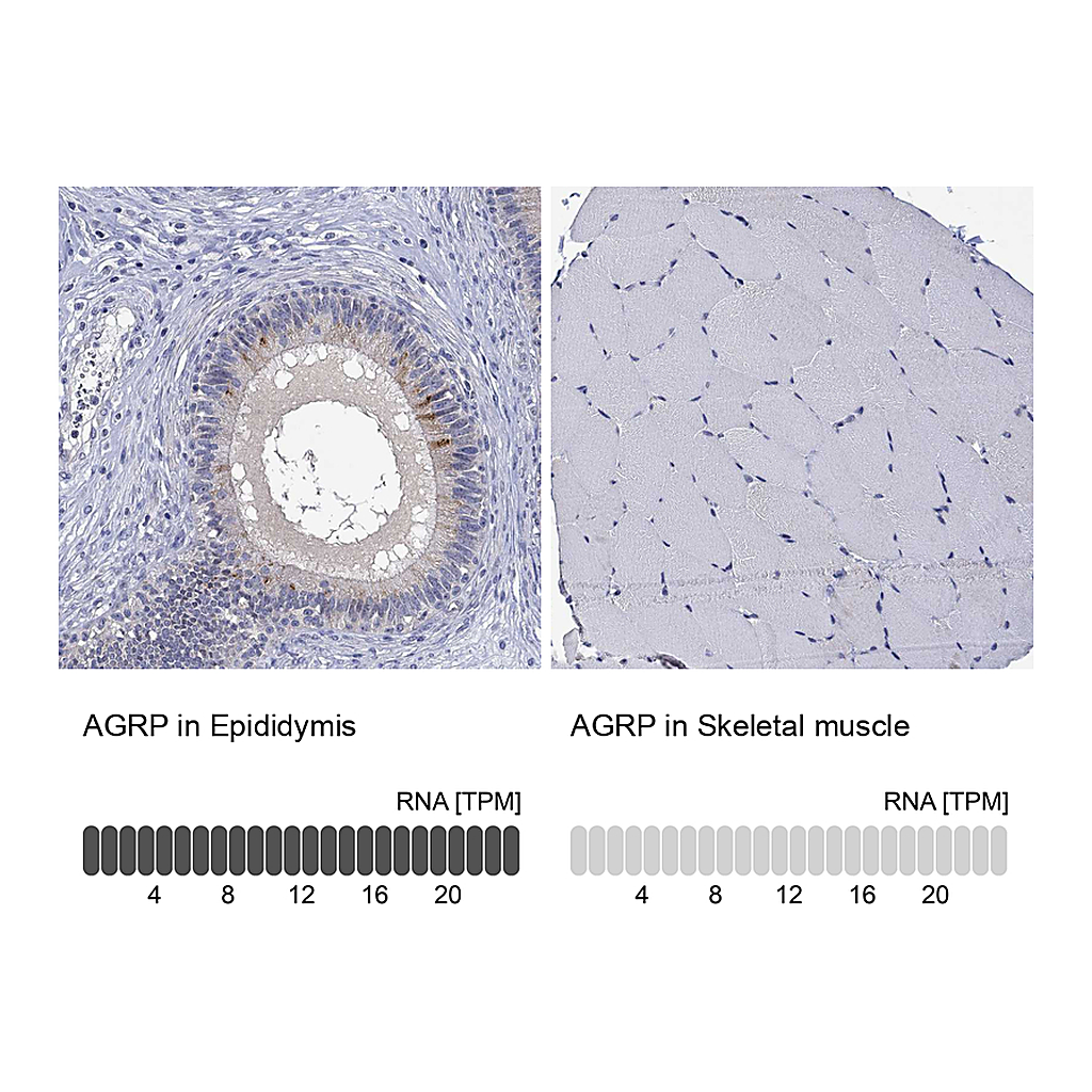 Atlas Antibodies Anti-AGRP Antibody