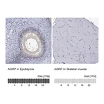 Atlas Antibodies Anti-AGRP Antibody