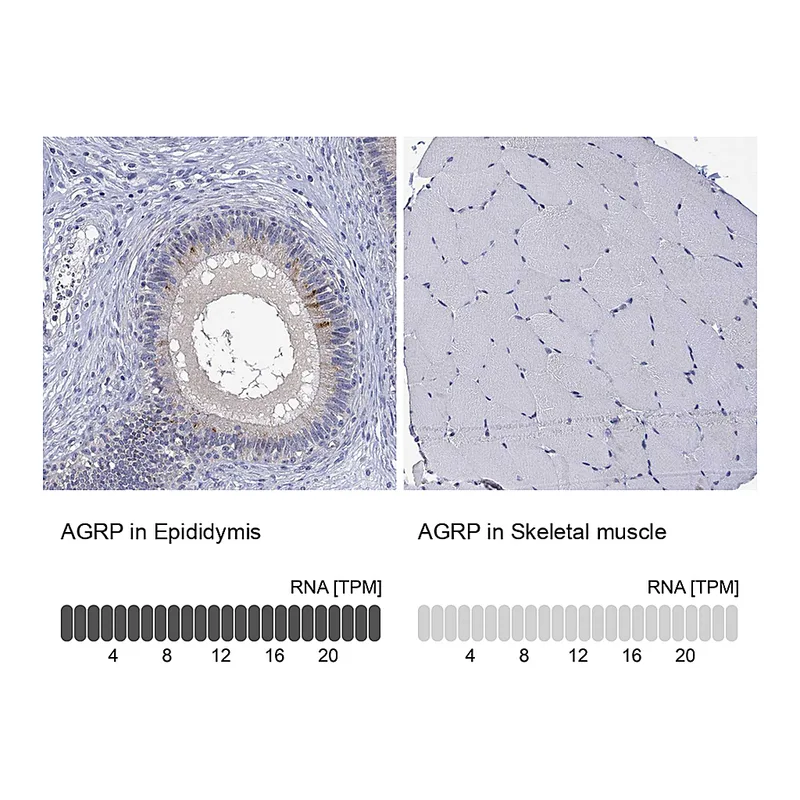 Atlas Antibodies Anti-AGRP Antibody