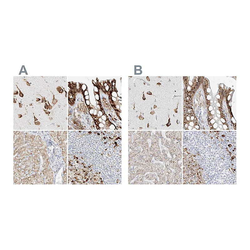 Atlas Antibodies Anti-LRRC59 Antibody