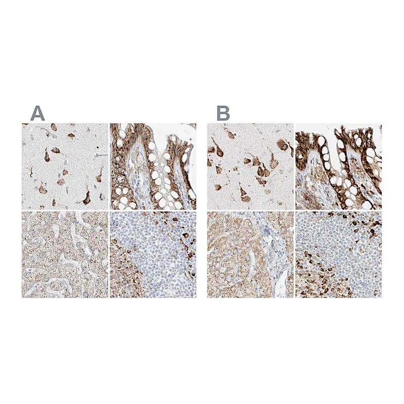 Atlas Antibodies Anti-LRRC59 Antibody