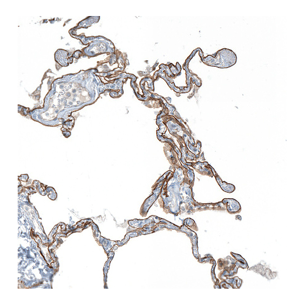 Atlas Antibodies Anti-AGRN Antibody