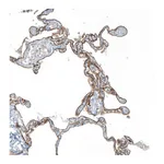 Atlas Antibodies Anti-AGRN Antibody