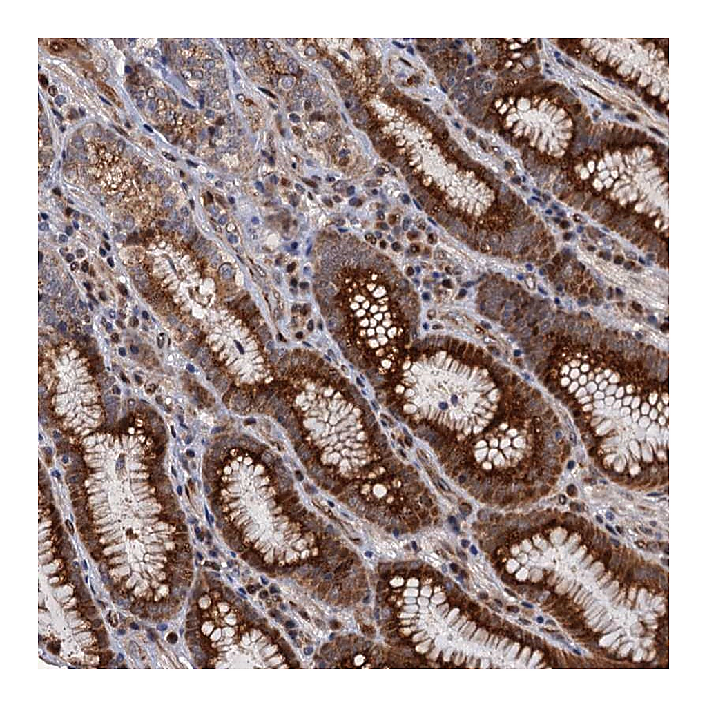 Atlas Antibodies Anti-LRRC63 Antibody