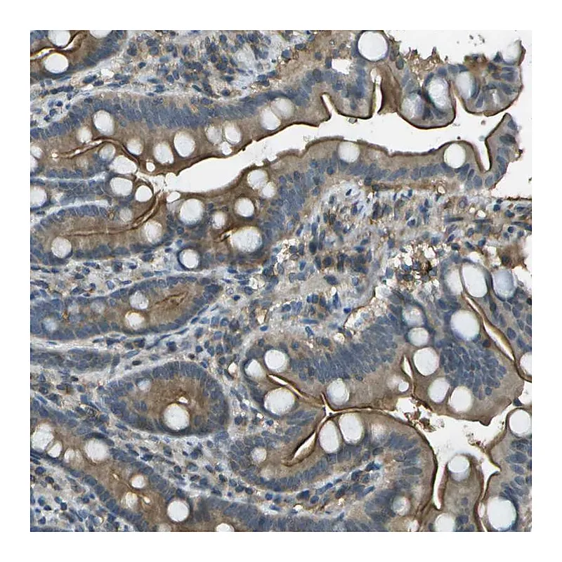 Atlas Antibodies Anti-LRRC66 Antibody