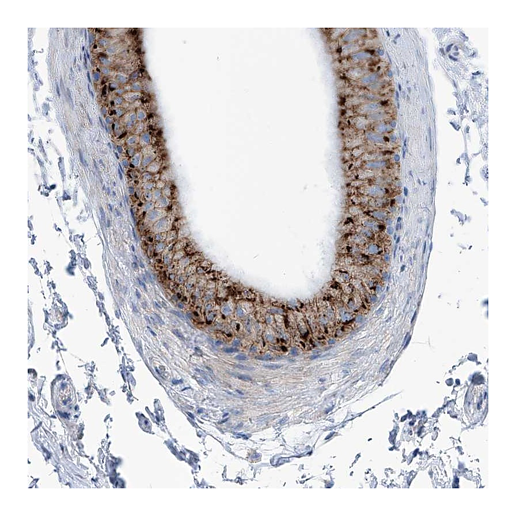 Atlas Antibodies Anti-AGPS Antibody