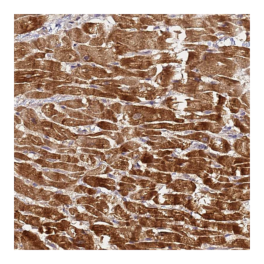 Atlas Antibodies Anti-LRRC69 Antibody