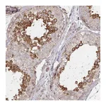Atlas Antibodies Anti-AGTPBP1 Antibody