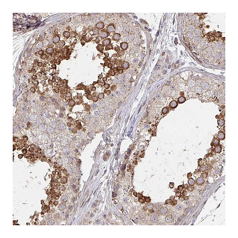 Atlas Antibodies Anti-AGTPBP1 Antibody