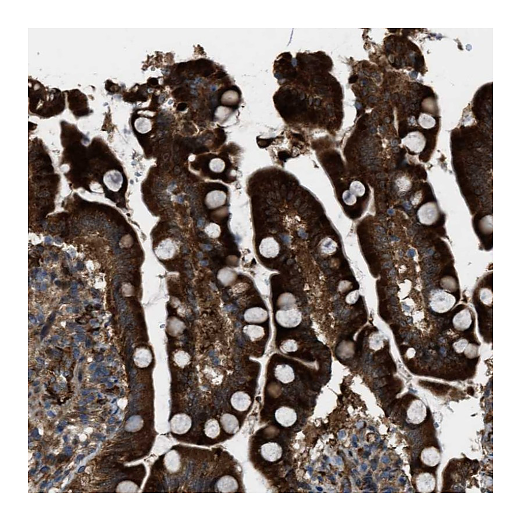 Atlas Antibodies Anti-LRRC72 Antibody