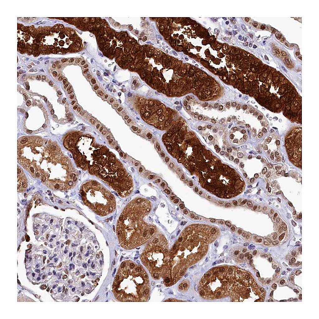 Atlas Antibodies Anti-AHCY Antibody