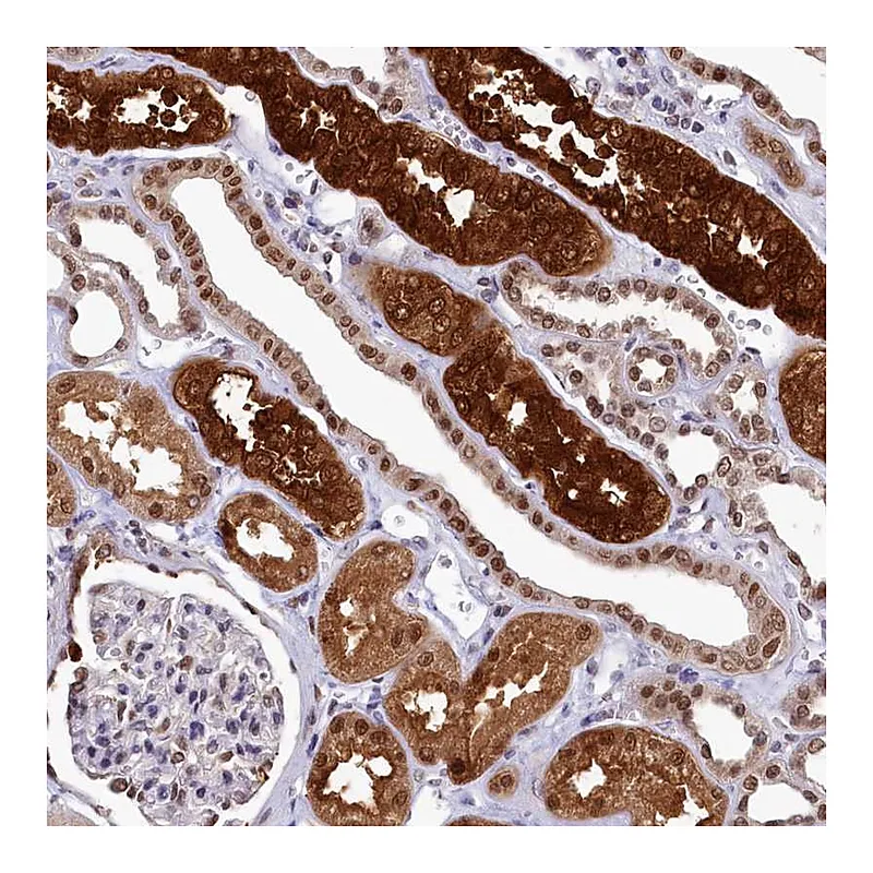Atlas Antibodies Anti-AHCY Antibody