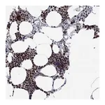 Atlas Antibodies Anti-AGTPBP1 Antibody