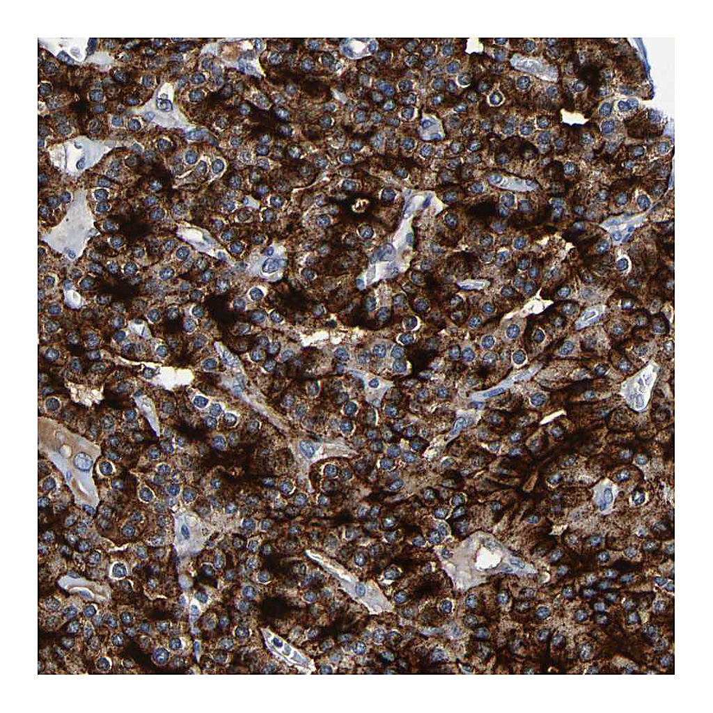 Atlas Antibodies Anti-LRRC70 Antibody