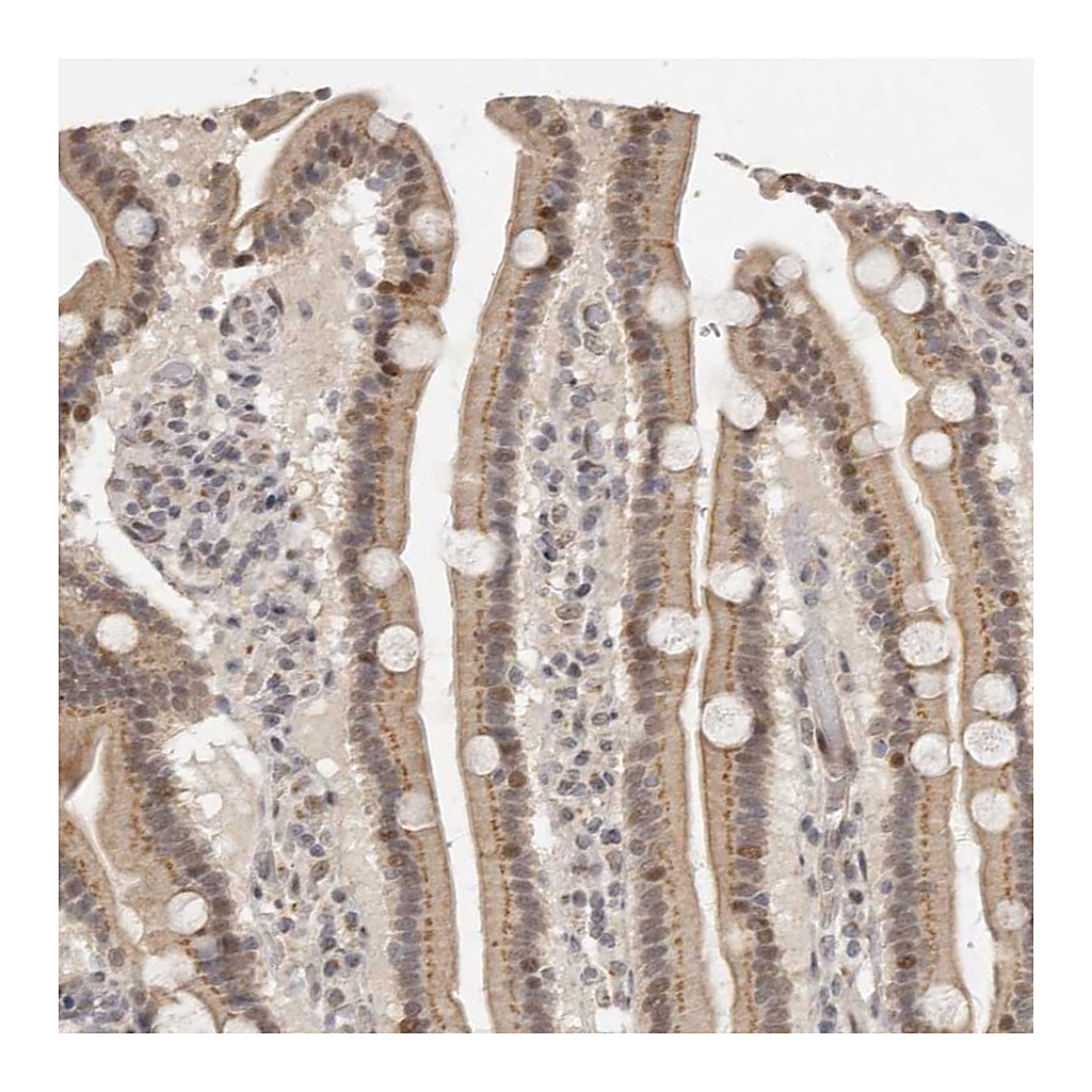 Atlas Antibodies Anti-LRRC75A Antibody