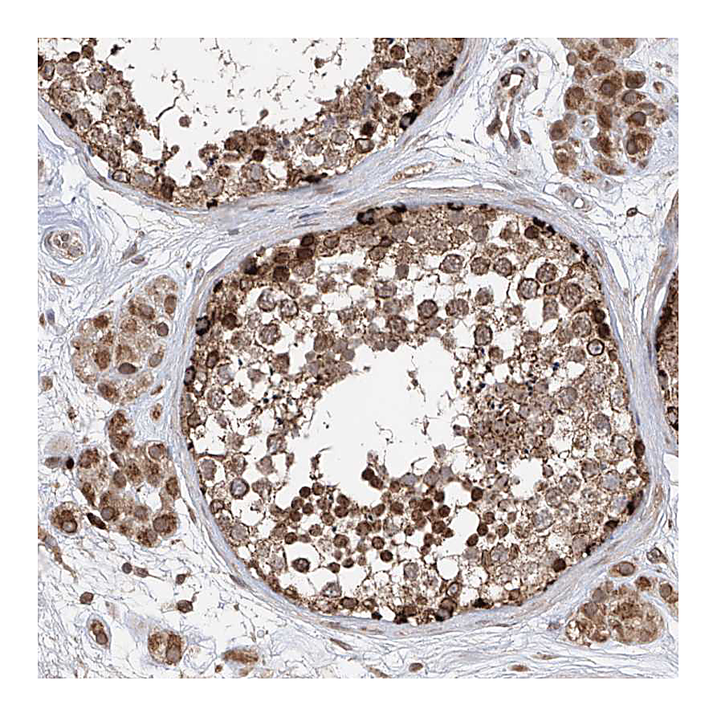Atlas Antibodies Anti-AHCTF1 Antibody