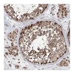 Atlas Antibodies Anti-AHCTF1 Antibody