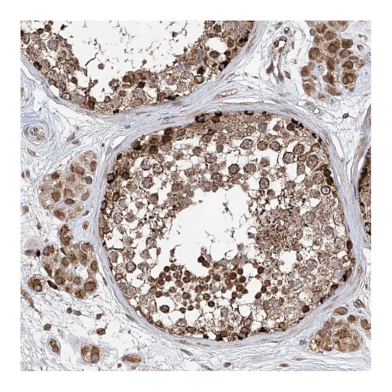 Atlas Antibodies Anti-AHCTF1 Antibody