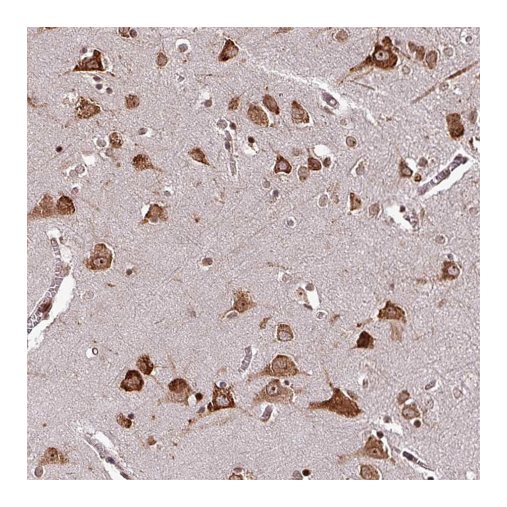 Atlas Antibodies Anti-LRRC74B Antibody