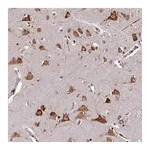 Atlas Antibodies Anti-LRRC74B Antibody
